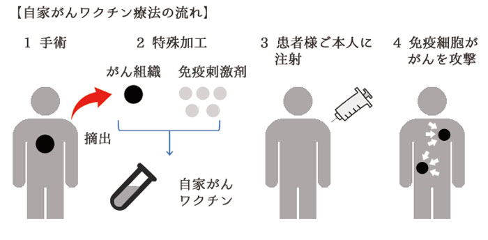 自家がんワクチン療法｜鳥取県鳥取市の内科・消化器科・がん治療