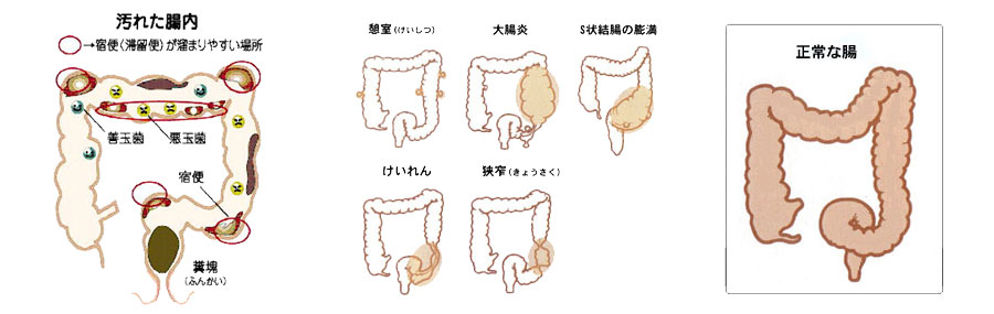 腸内環境改善 | 鳥取のよろずクリニック